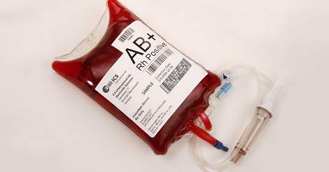 Red Blood Cell Transfusion