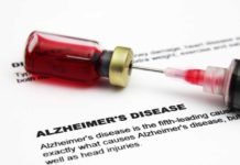 alzheimer-disease