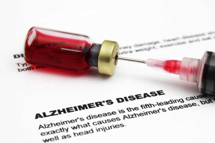 alzheimer-disease