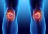 arthroscopic knee surgery