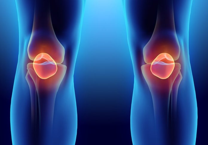 arthroscopic knee surgery