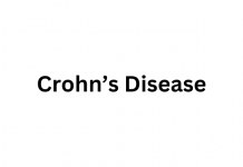 Crohn’s Disease