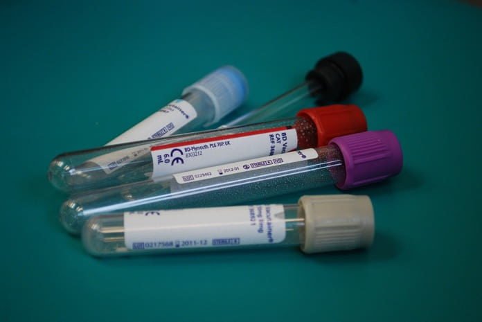 blood test to detect cancer