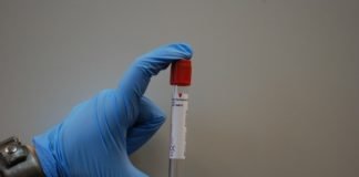 rapid HIV test