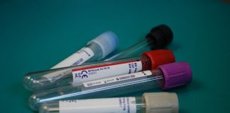 fibromyalgia blood test