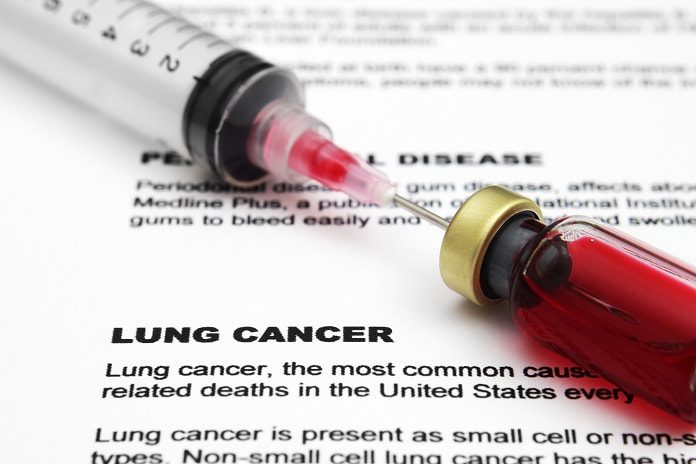high-dose radiation for lung cancer
