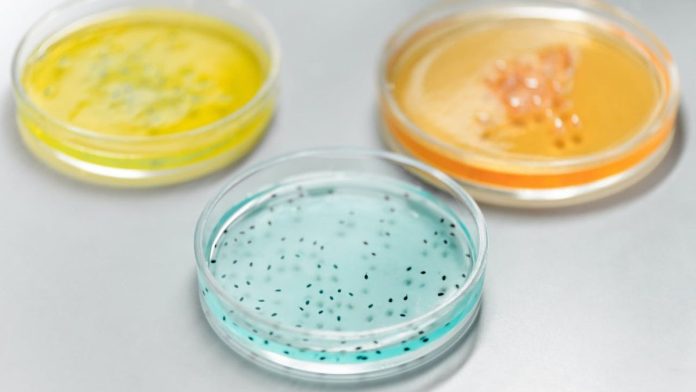bacteria on the skin help diagnose childhood eczema