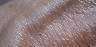 where does skin cancer begin