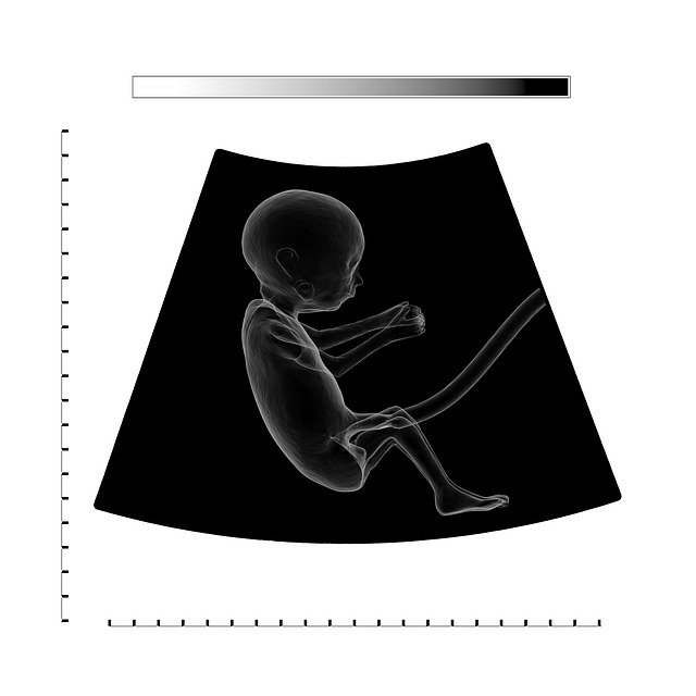 in-utero MRI