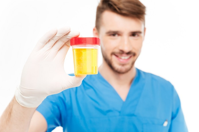 Urine test for prostate cancer