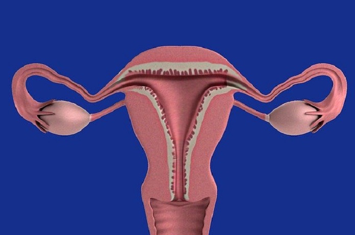 hormone-releasing intrauterine device