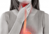 home remedies for acid reflux
