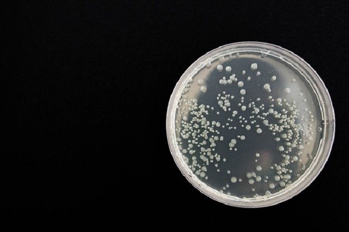 petri dish with microorganisms