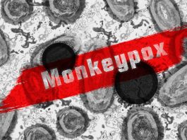 An abstract representation of the monkeypox virus.