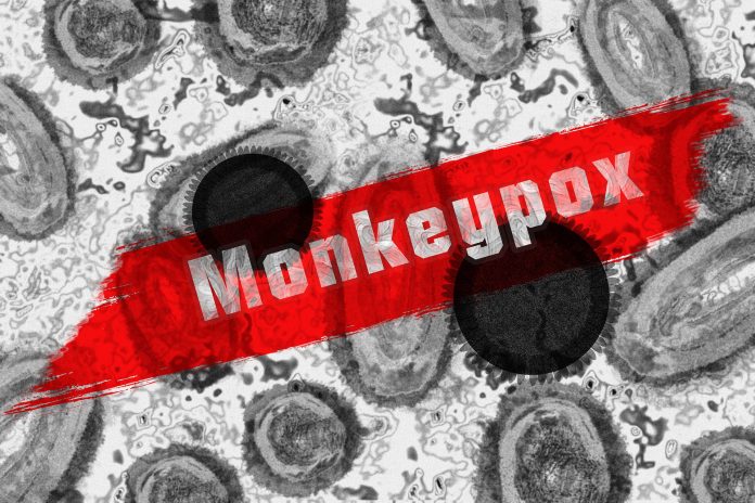An abstract representation of the monkeypox virus.