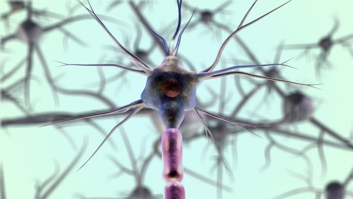 Neuron cell body involved in paralysis.