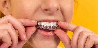 An at-home hydrogen peroxide teeth whitening mouthguard being applied, but is it safe?