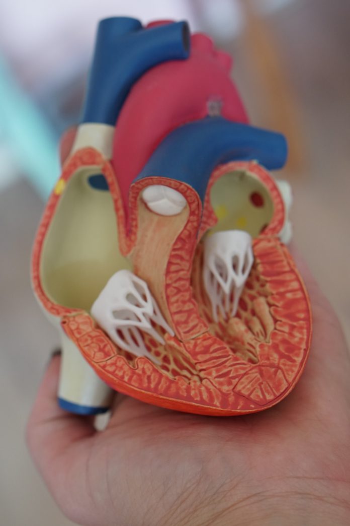 A model of a heart to demonstrate the region of the heart associated with mitral valve prolapse and its connective tissue.