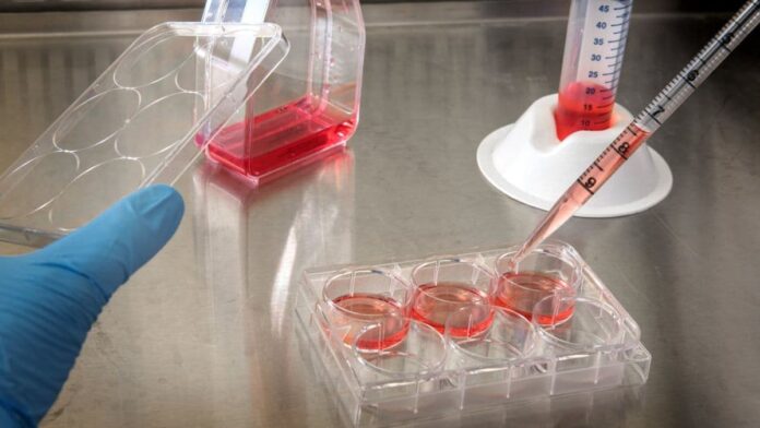 DCIS malignancy test on the way? - Image by CDC from Pexels